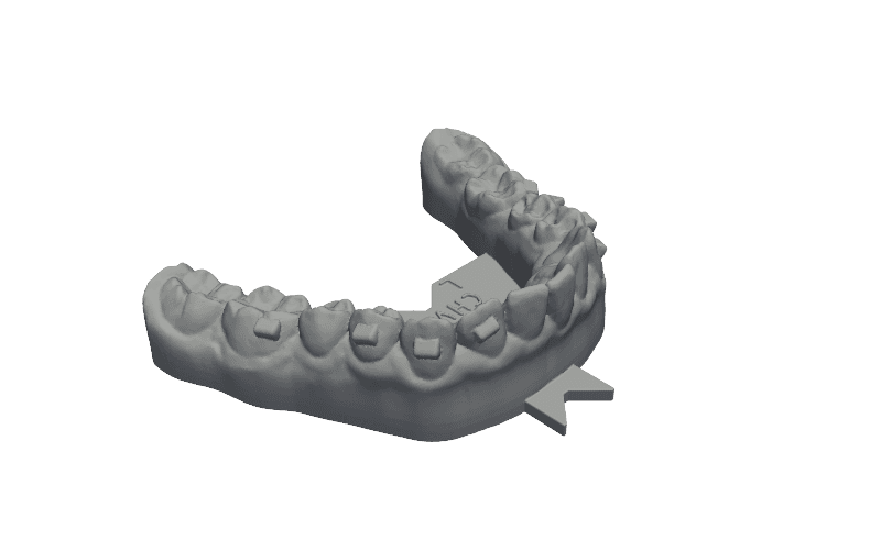 Stock dental aligner mold — original geometry as uploaded