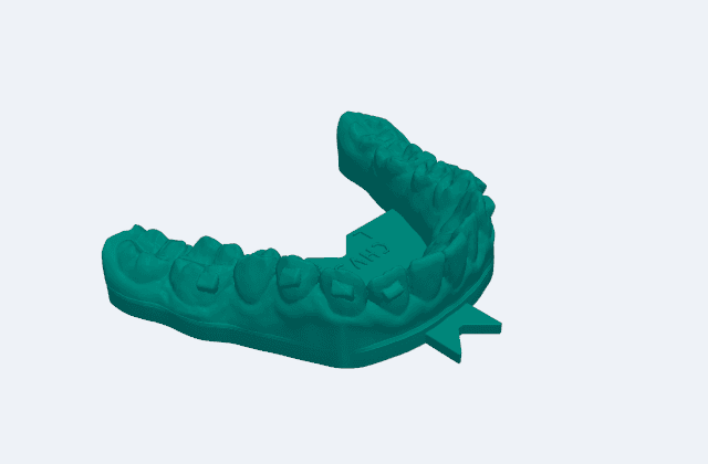MoldLean-optimized dental aligner mold — same fit, leaner base